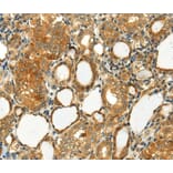 Immunohistochemistry - SEMA4C Antibody from Signalway Antibody (40099) - Antibodies.com