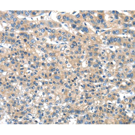 Immunohistochemistry - DNAJA3 Antibody from Signalway Antibody (40102) - Antibodies.com