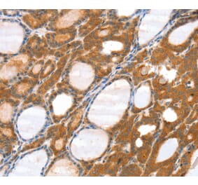 Immunohistochemistry - SRGAP3 Antibody from Signalway Antibody (40116) - Antibodies.com