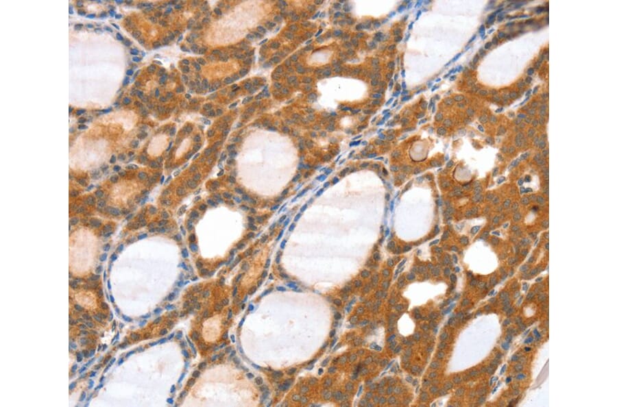 Immunohistochemistry - SRGAP3 Antibody from Signalway Antibody (40116) - Antibodies.com