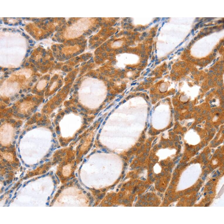 Immunohistochemistry - SRGAP3 Antibody from Signalway Antibody (40116) - Antibodies.com