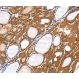 Immunohistochemistry - SRGAP3 Antibody from Signalway Antibody (40116) - Antibodies.com