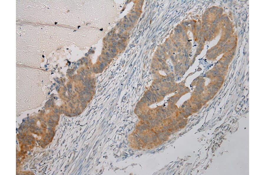 Immunohistochemistry - ARMC10 Antibody from Signalway Antibody (40125) - Antibodies.com