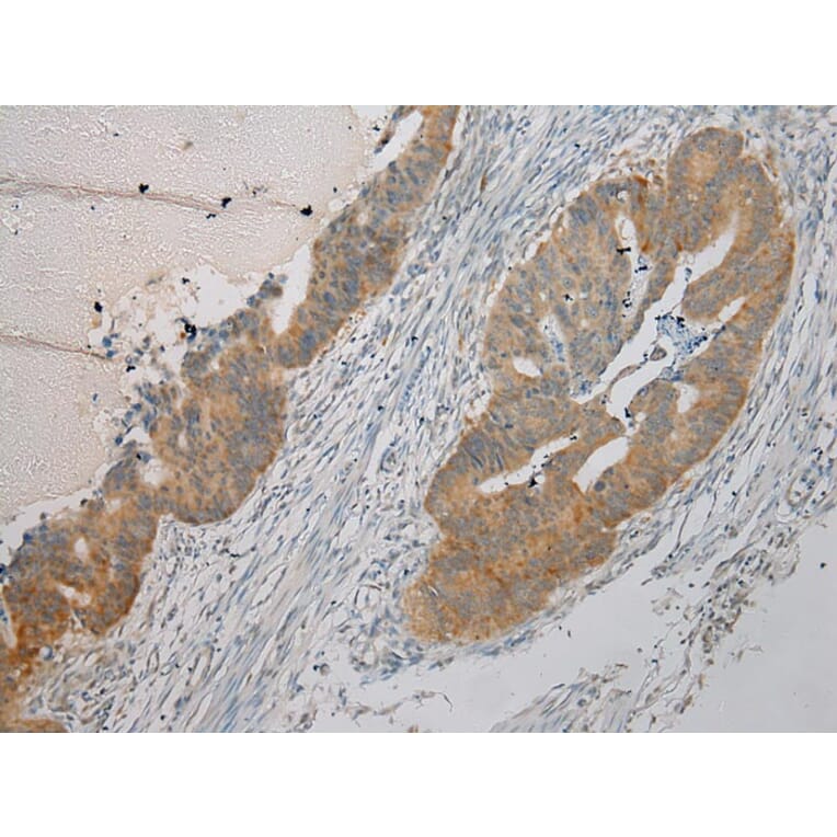 Immunohistochemistry - ARMC10 Antibody from Signalway Antibody (40125) - Antibodies.com
