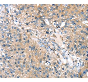 Immunohistochemistry - STXBP4 Antibody from Signalway Antibody (40130) - Antibodies.com