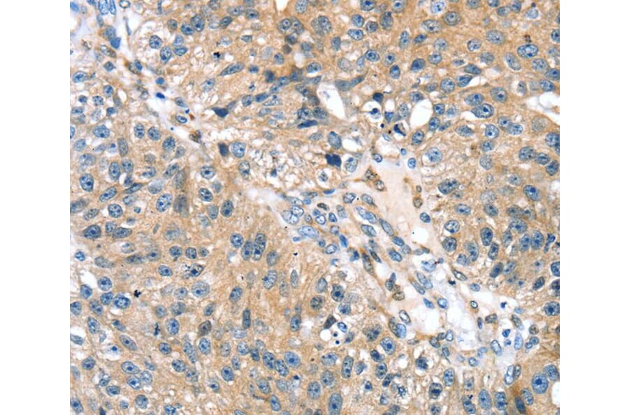 Immunohistochemistry - STXBP4 Antibody from Signalway Antibody (40130) - Antibodies.com
