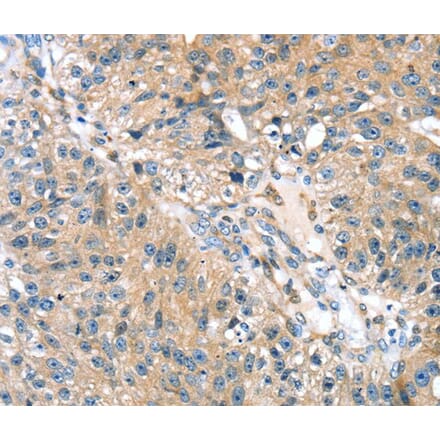 Immunohistochemistry - STXBP4 Antibody from Signalway Antibody (40130) - Antibodies.com