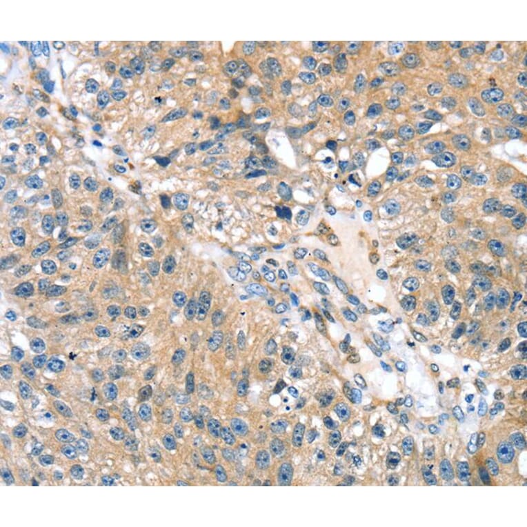 Immunohistochemistry - STXBP4 Antibody from Signalway Antibody (40130) - Antibodies.com