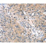 Immunohistochemistry - STXBP4 Antibody from Signalway Antibody (40130) - Antibodies.com