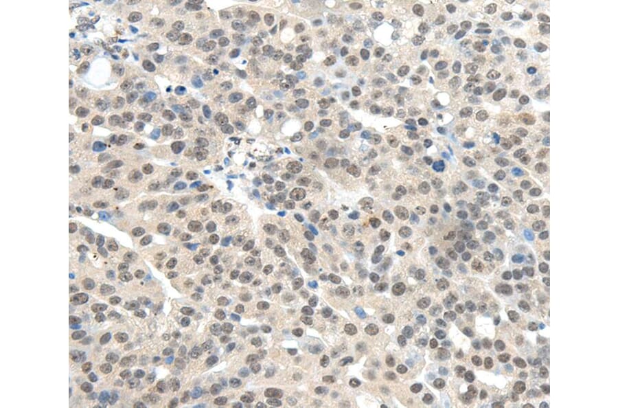 Immunohistochemistry - TRIM11 Antibody from Signalway Antibody (40148) - Antibodies.com