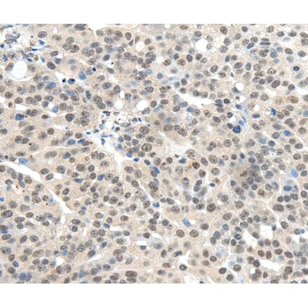 Immunohistochemistry - TRIM11 Antibody from Signalway Antibody (40148) - Antibodies.com