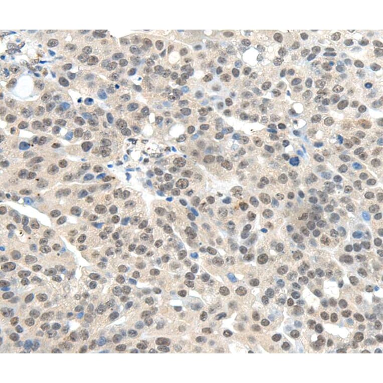 Immunohistochemistry - TRIM11 Antibody from Signalway Antibody (40148) - Antibodies.com