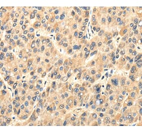 Immunohistochemistry - TWIST2 Antibody from Signalway Antibody (40170) - Antibodies.com