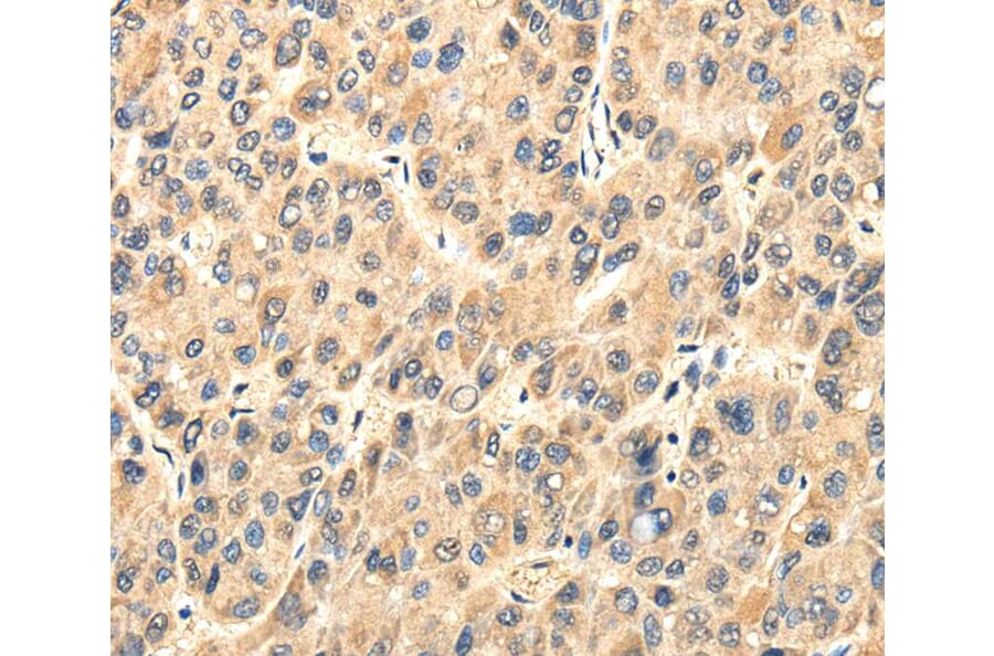 Immunohistochemistry - TWIST2 Antibody from Signalway Antibody (40170) - Antibodies.com