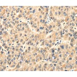 Immunohistochemistry - TWIST2 Antibody from Signalway Antibody (40170) - Antibodies.com