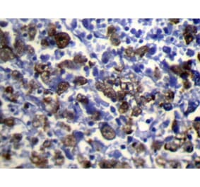 Immunohistochemistry - UGT2B4 Antibody from Signalway Antibody (40178) - Antibodies.com