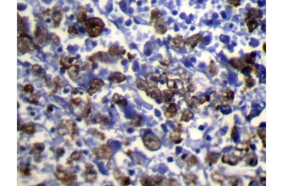Immunohistochemistry - UGT2B4 Antibody from Signalway Antibody (40178) - Antibodies.com