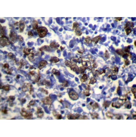 Immunohistochemistry - UGT2B4 Antibody from Signalway Antibody (40178) - Antibodies.com