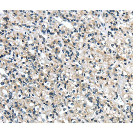 Immunohistochemistry - GRIN2A Antibody from Signalway Antibody (40188) - Antibodies.com