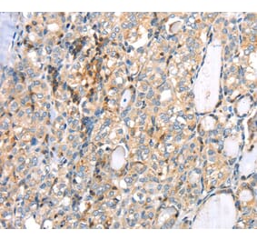 Immunohistochemistry - MAGEB2 Antibody from Signalway Antibody (40202) - Antibodies.com