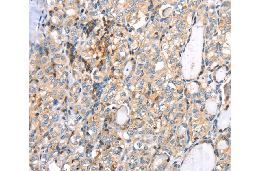 Immunohistochemistry - MAGEB2 Antibody from Signalway Antibody (40202) - Antibodies.com