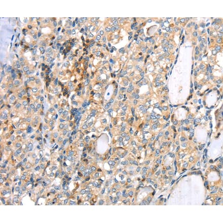 Immunohistochemistry - MAGEB2 Antibody from Signalway Antibody (40202) - Antibodies.com