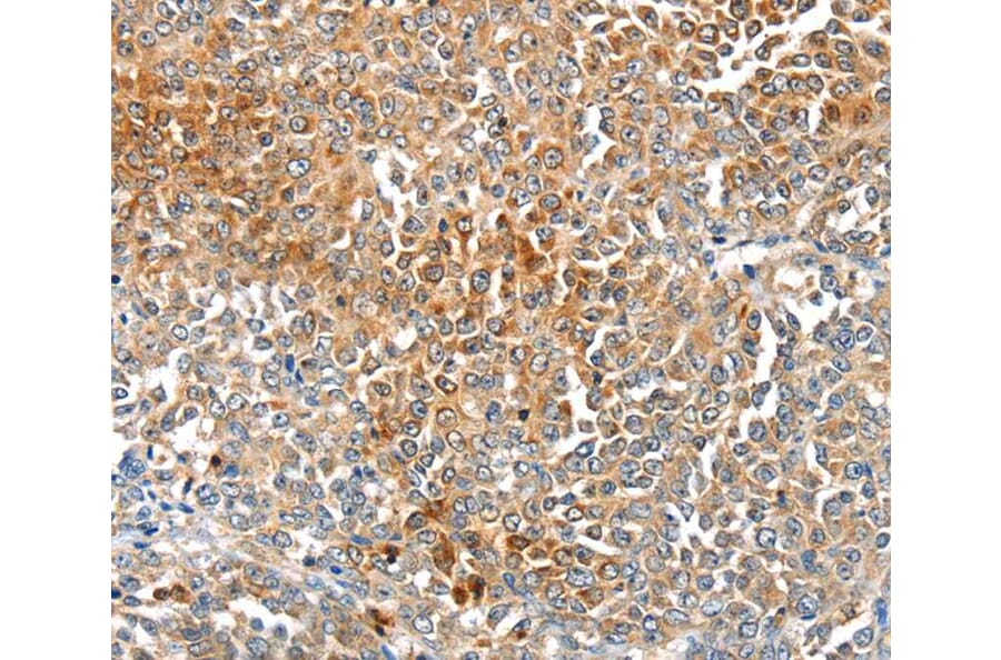 Immunohistochemistry - MAGEB2 Antibody from Signalway Antibody (40202) - Antibodies.com