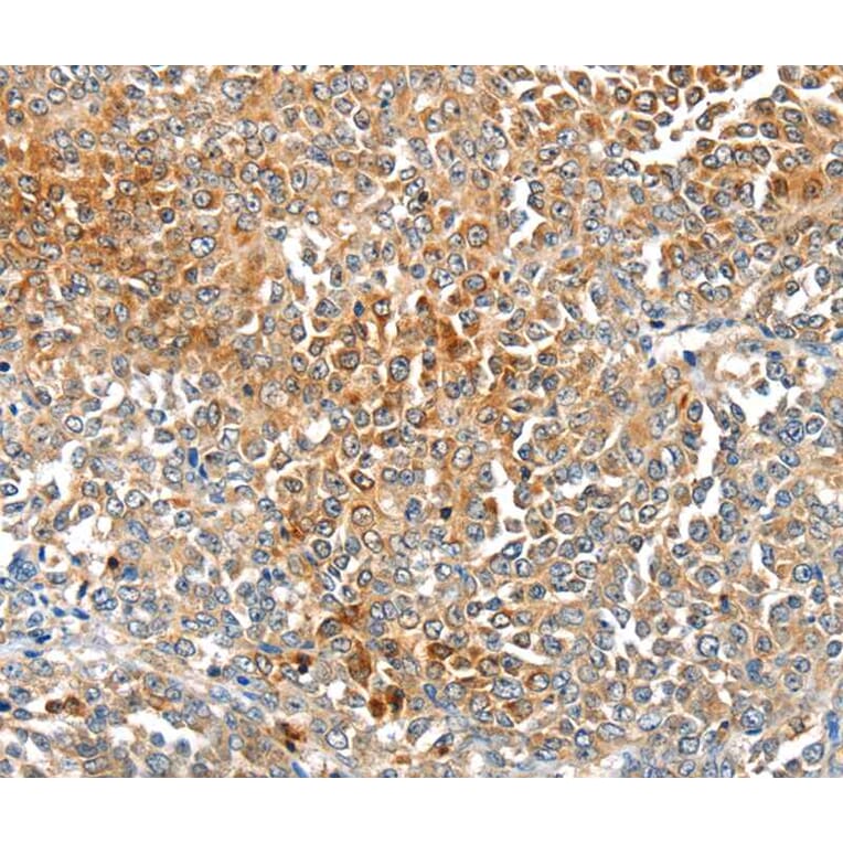 Immunohistochemistry - MAGEB2 Antibody from Signalway Antibody (40202) - Antibodies.com
