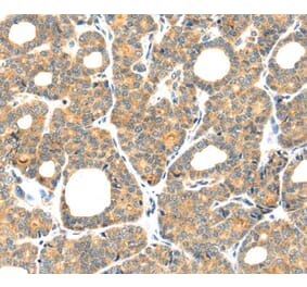 Immunohistochemistry - PLAGL2 Antibody from Signalway Antibody (40205) - Antibodies.com