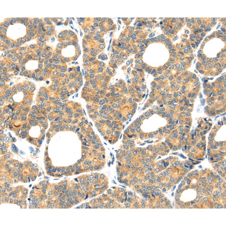 Immunohistochemistry - PLAGL2 Antibody from Signalway Antibody (40205) - Antibodies.com