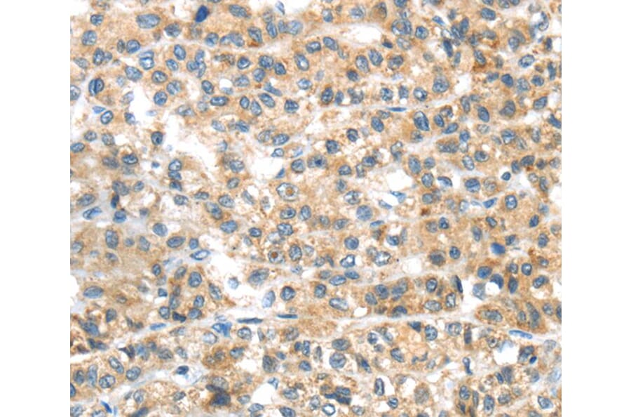 Immunohistochemistry - PLAGL2 Antibody from Signalway Antibody (40205) - Antibodies.com