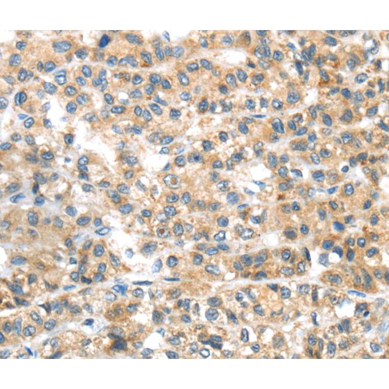 Immunohistochemistry - PLAGL2 Antibody from Signalway Antibody (40205) - Antibodies.com