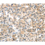 Immunohistochemistry - PLAGL2 Antibody from Signalway Antibody (40205) - Antibodies.com