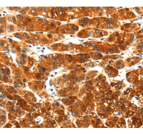 Immunohistochemistry - PLXNA3 Antibody from Signalway Antibody (40206) - Antibodies.com