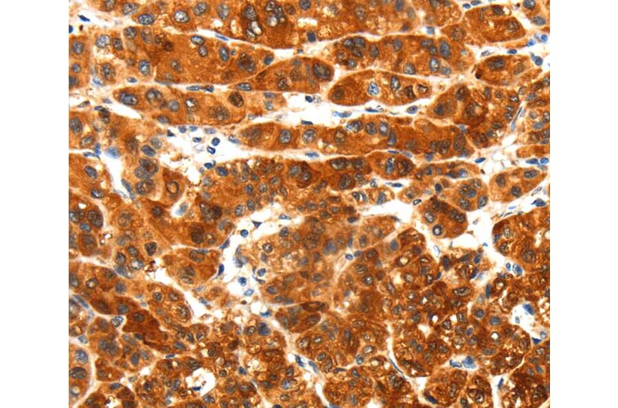 Immunohistochemistry - PLXNA3 Antibody from Signalway Antibody (40206) - Antibodies.com