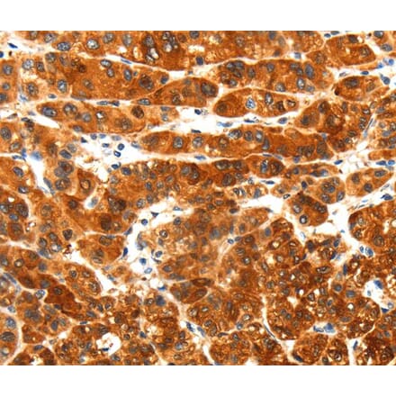 Immunohistochemistry - PLXNA3 Antibody from Signalway Antibody (40206) - Antibodies.com