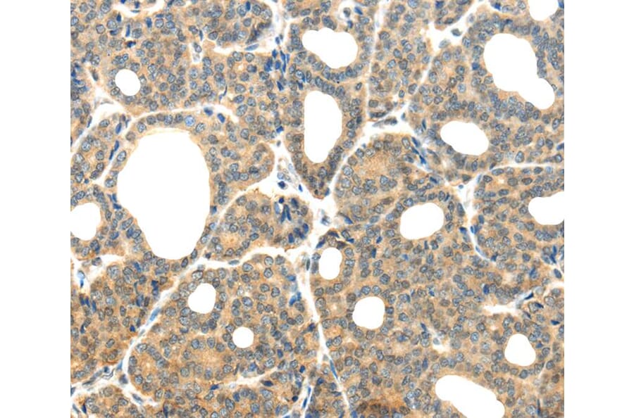 Immunohistochemistry - PLXNB2 Antibody from Signalway Antibody (40207) - Antibodies.com