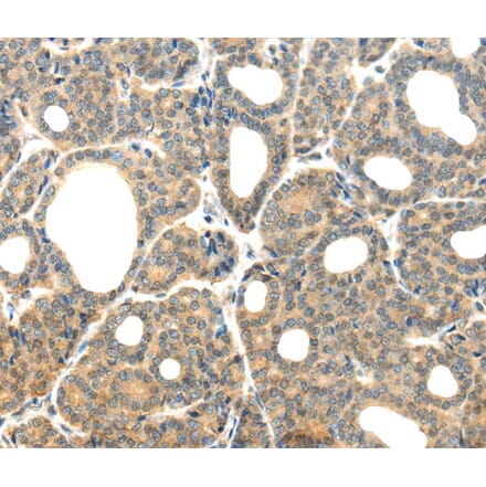 Immunohistochemistry - PLXNB2 Antibody from Signalway Antibody (40207) - Antibodies.com