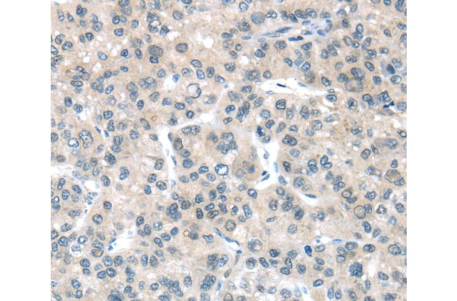 Immunohistochemistry - PLXNB2 Antibody from Signalway Antibody (40207) - Antibodies.com