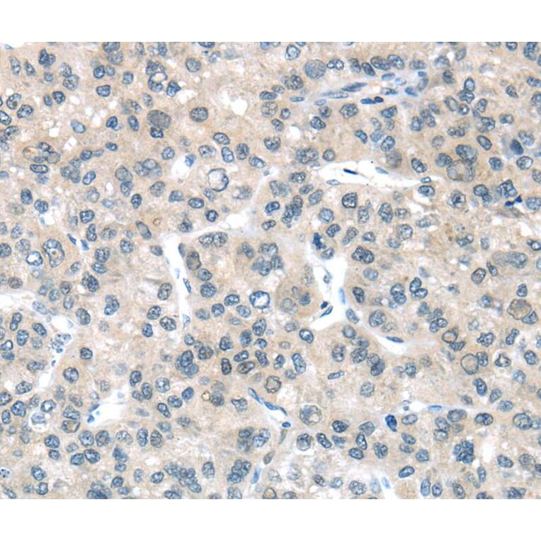 Immunohistochemistry - PLXNB2 Antibody from Signalway Antibody (40207) - Antibodies.com