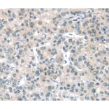 Immunohistochemistry - PLXNB2 Antibody from Signalway Antibody (40207) - Antibodies.com