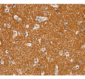 Immunohistochemistry - STK32A Antibody from Signalway Antibody (40226) - Antibodies.com