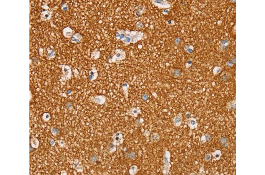 Immunohistochemistry - STK32A Antibody from Signalway Antibody (40226) - Antibodies.com