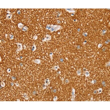Immunohistochemistry - STK32A Antibody from Signalway Antibody (40226) - Antibodies.com