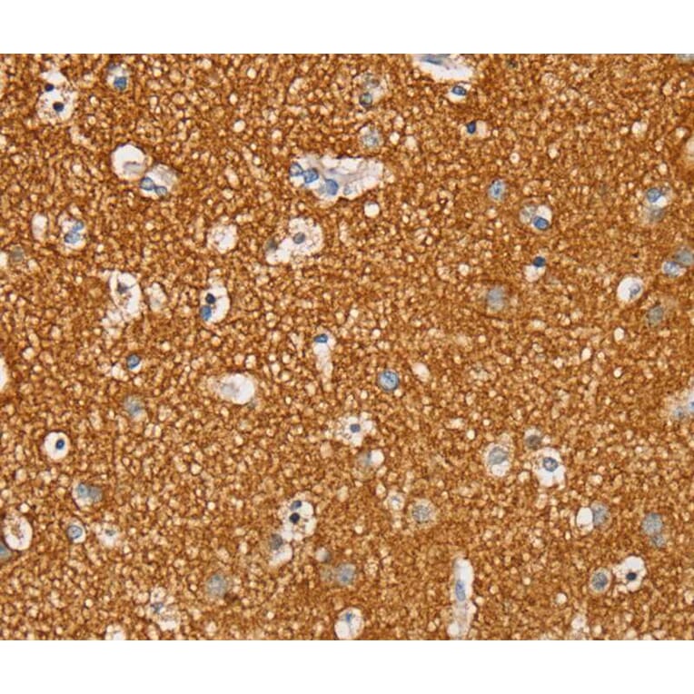 Immunohistochemistry - STK32A Antibody from Signalway Antibody (40226) - Antibodies.com