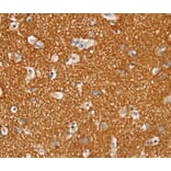 Immunohistochemistry - STK32A Antibody from Signalway Antibody (40226) - Antibodies.com