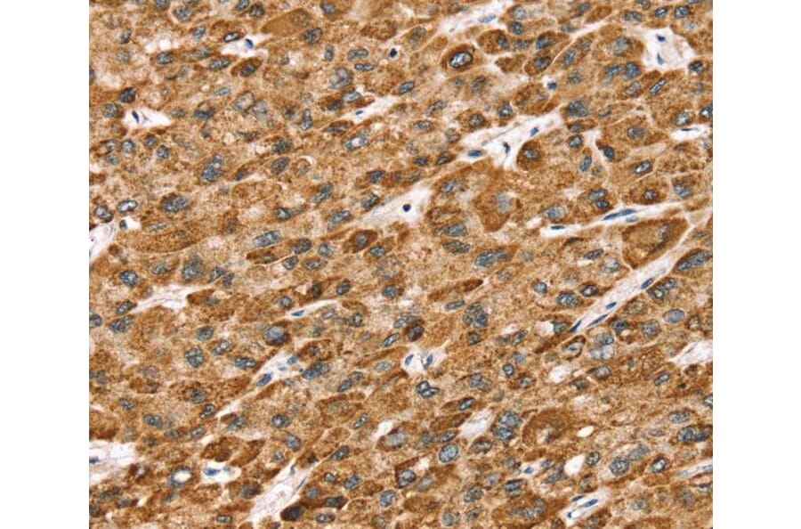 Immunohistochemistry - STK32B Antibody from Signalway Antibody (40227) - Antibodies.com