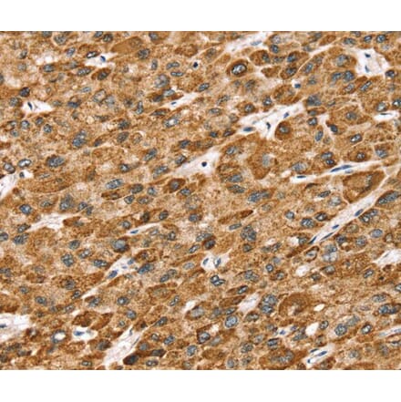Immunohistochemistry - STK32B Antibody from Signalway Antibody (40227) - Antibodies.com