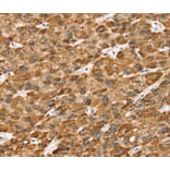 Immunohistochemistry - STK32B Antibody from Signalway Antibody (40227) - Antibodies.com
