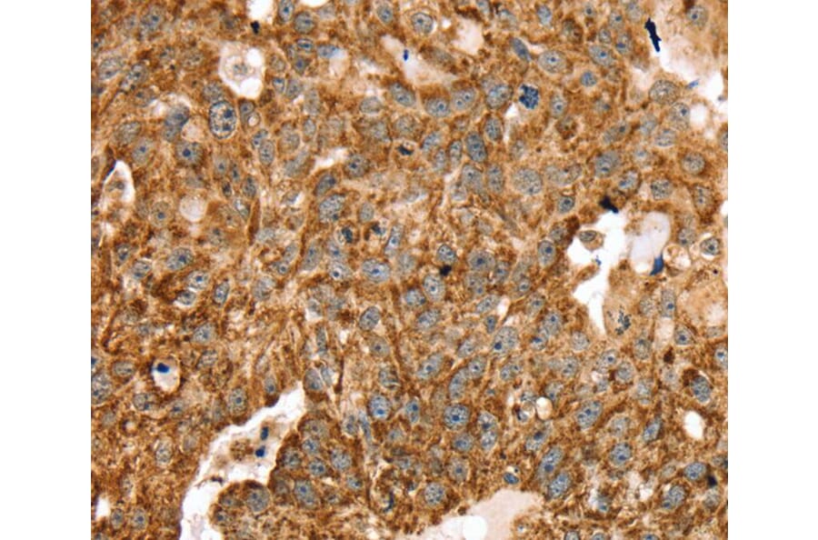 Immunohistochemistry - STK32B Antibody from Signalway Antibody (40227) - Antibodies.com